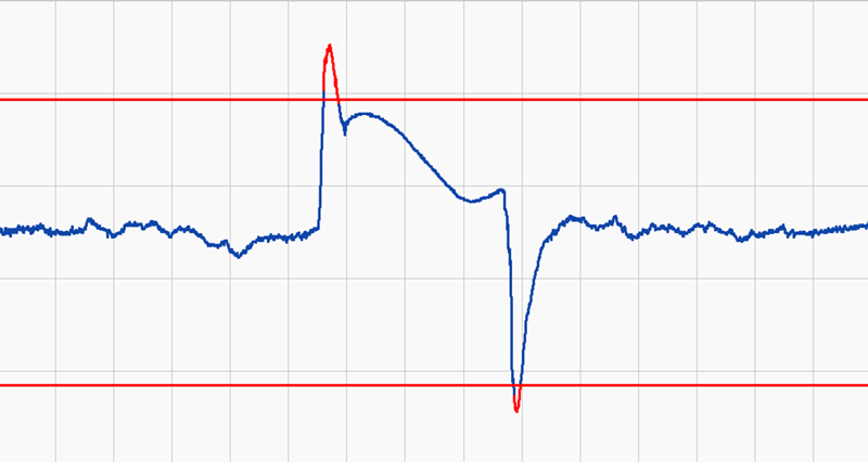 time series anomaly detection - standard deviation