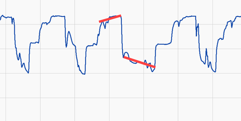 time series anomaly detection - variability